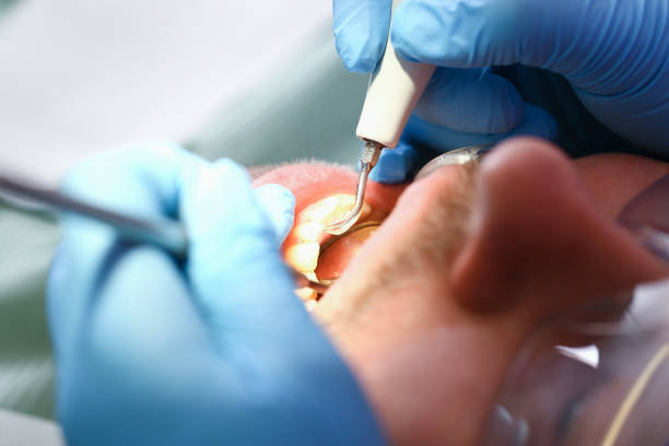 Best Emergency Care for Gum Disease in Twinsburg Heights, OH