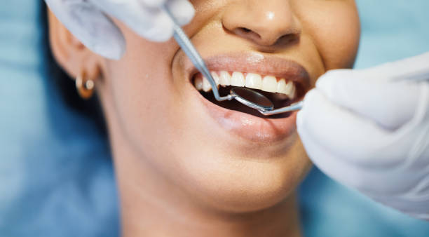 Best Dental Abscess Treatment in Twinsburg Heights, OH